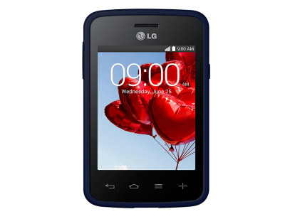 LG L30